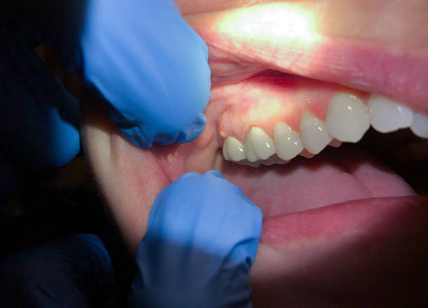 Best Pediatric Emergency Dentist in Parsippany, NJ