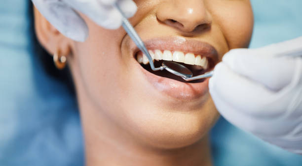 Best Emergency Denture Repair in Parsippany, NJ