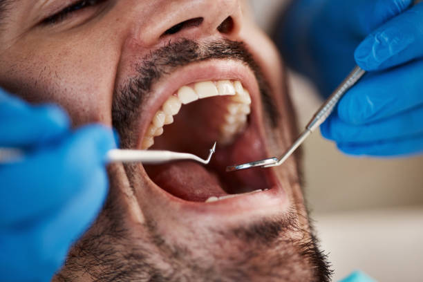 Best Emergency Tooth Extraction in Parsippany, NJ