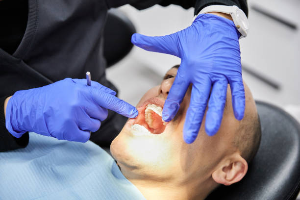Best Emergency Tooth Extraction in Parsippany, NJ